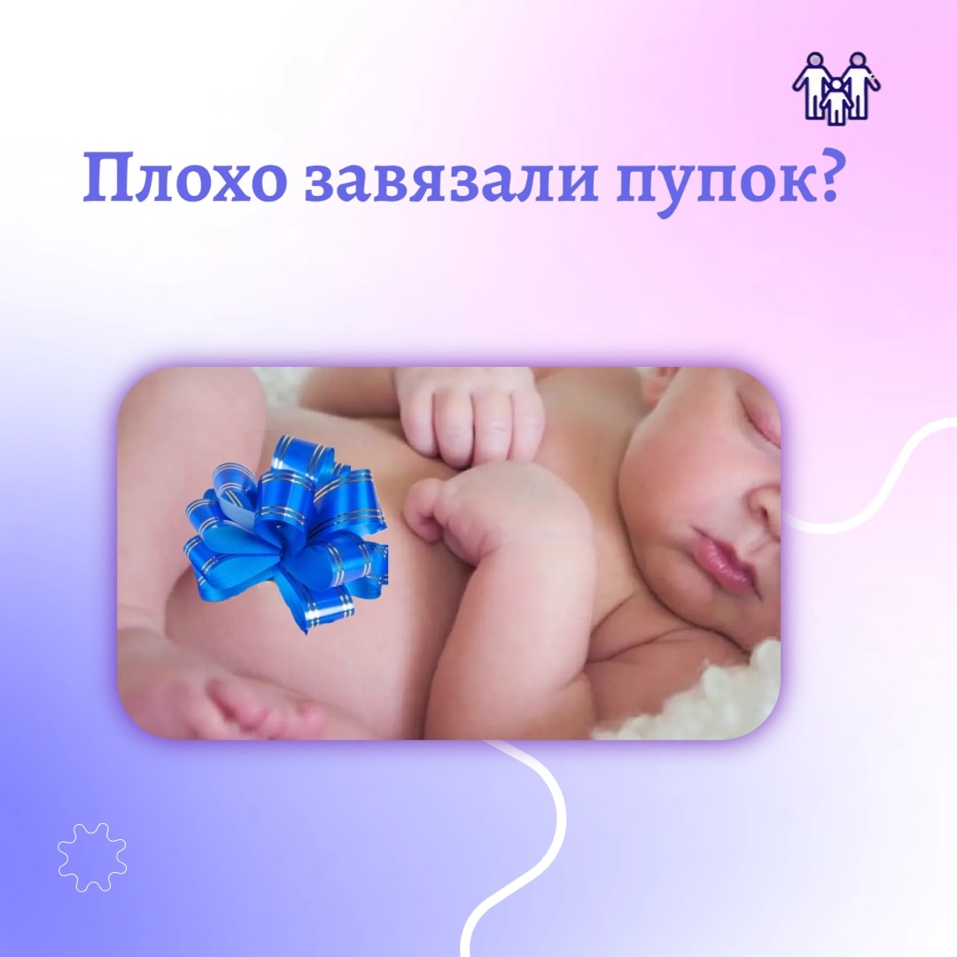 Пупок новорожденного: миф и правда о том, как его 'завязывают'!